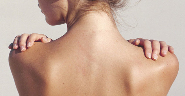 trị mụn thâm lưng ở bevita