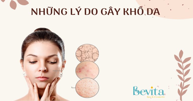 6 Lý do khiến da bị khô dù thoa dưỡng ẩm thường xuyên