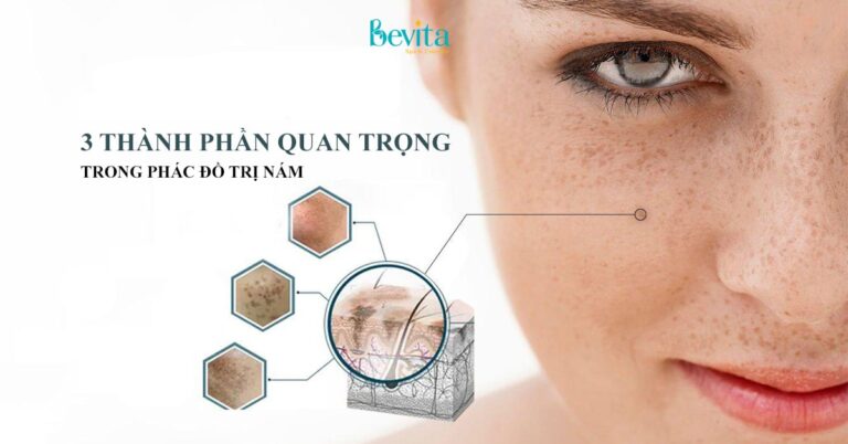 Top 3 thành phần mỹ phẩm quan trọng trong phác đồ điều trị nám