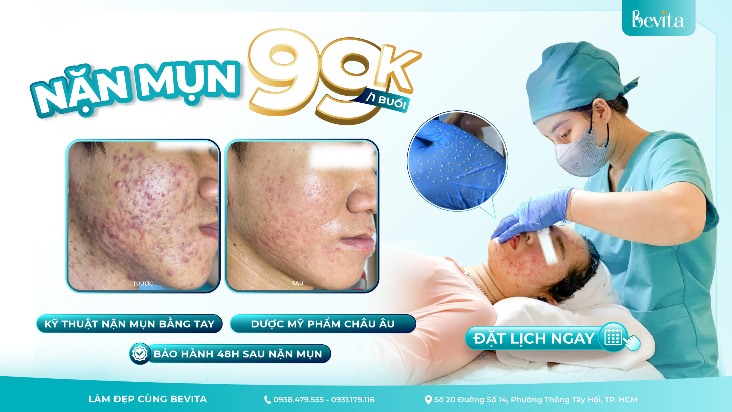 Bevita Acnes – Nặn Mụn Chuẩn Spa Chỉ 99K, Da Sạch – Mịn – Không Để Lại Thâm